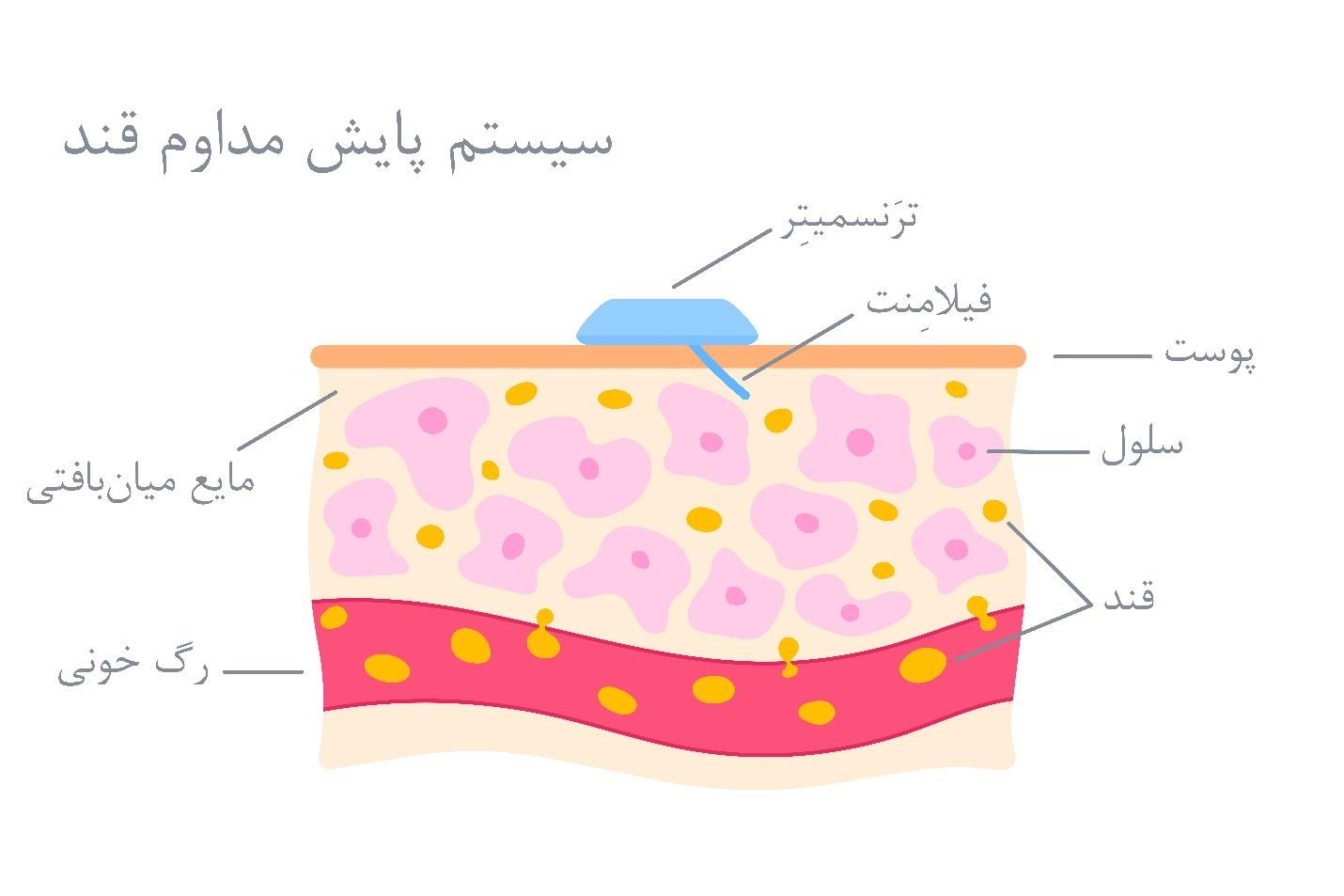 اجزای سنسور