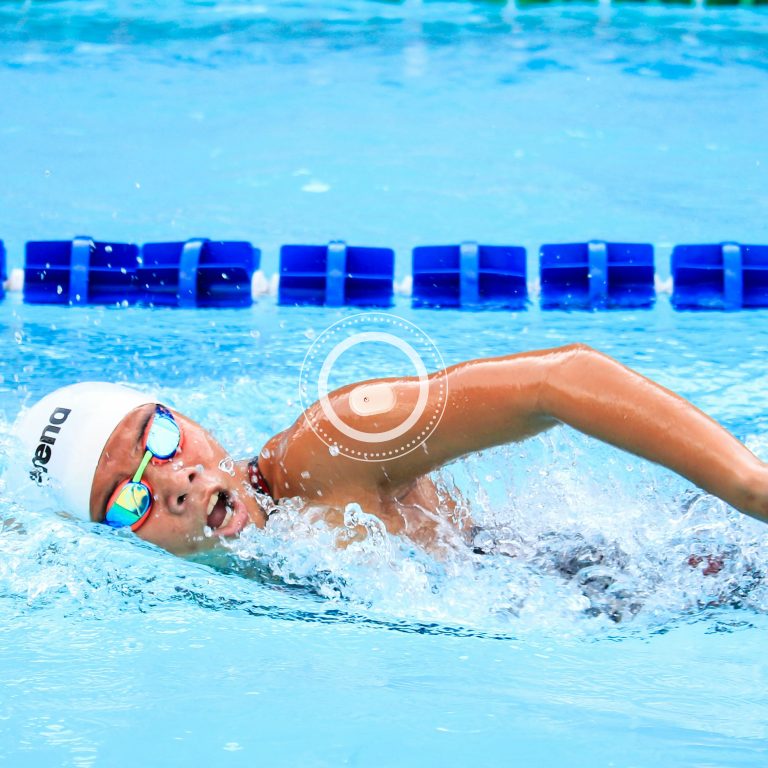 سیستمهای پایش مداوم قند سایبایونیکس