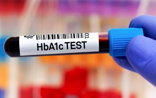 HBA1c چیست؟ هموگلوبین a1c نرمال چند است؟ آزمایش ای وان سی یا قند خون سه ماهه