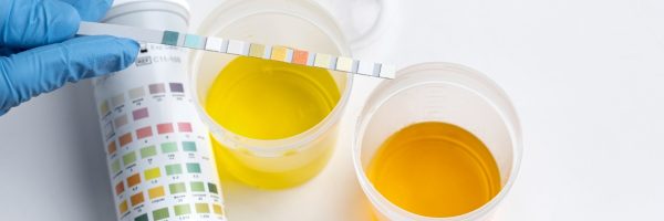 کتواسیدوز دیابتی