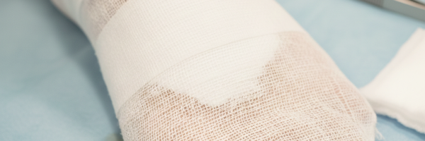 درمان زخم پای دیابتی